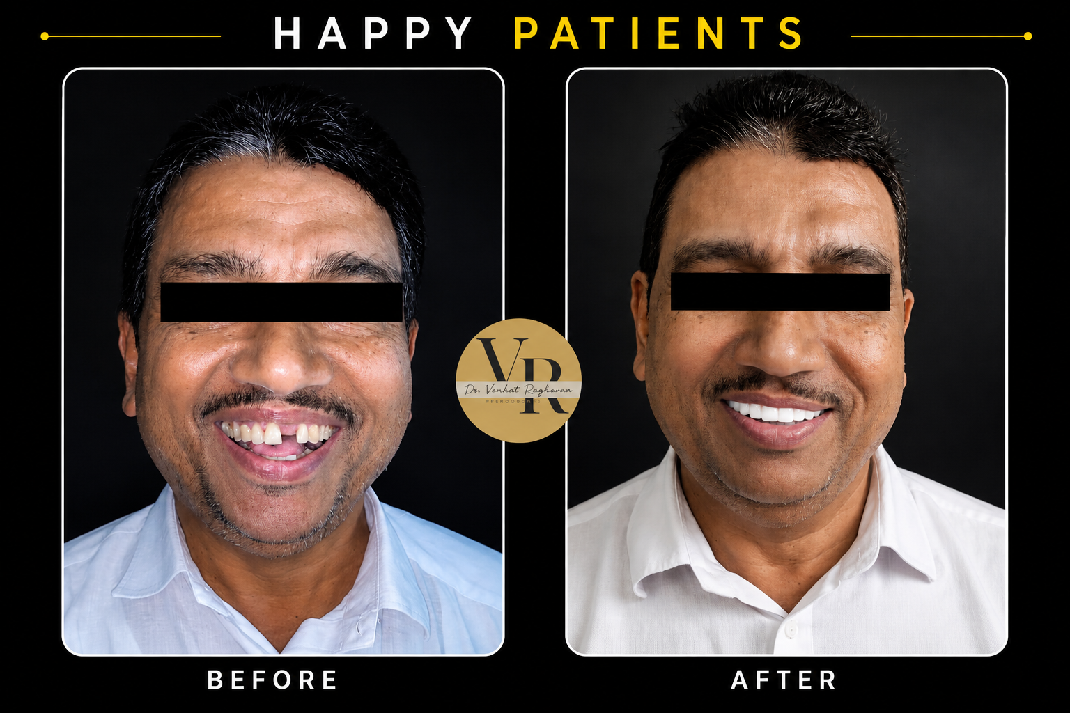 Dental Implants